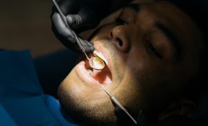 Forstå din behandling med tandkroner i Søborg